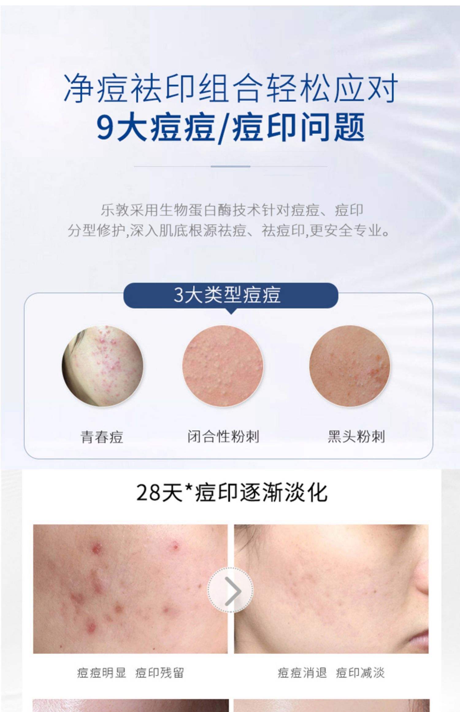 乐敦药妆祛痘膏多少钱乐敦药妆祛痘膏香港价格
