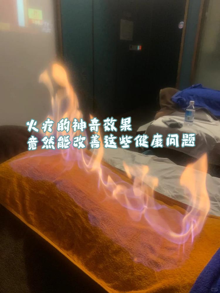 火疗是传销吗火疗是怎么操作的