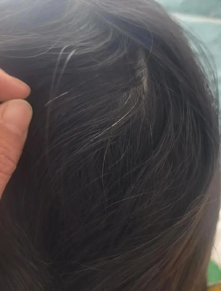 女人梦见自己头发白了